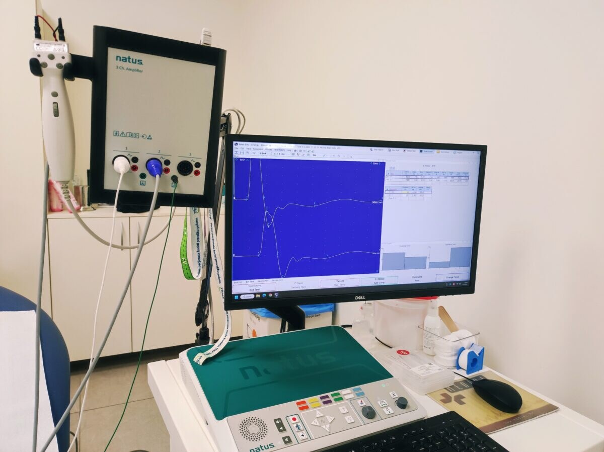 Elektromioneurografija - EMNG